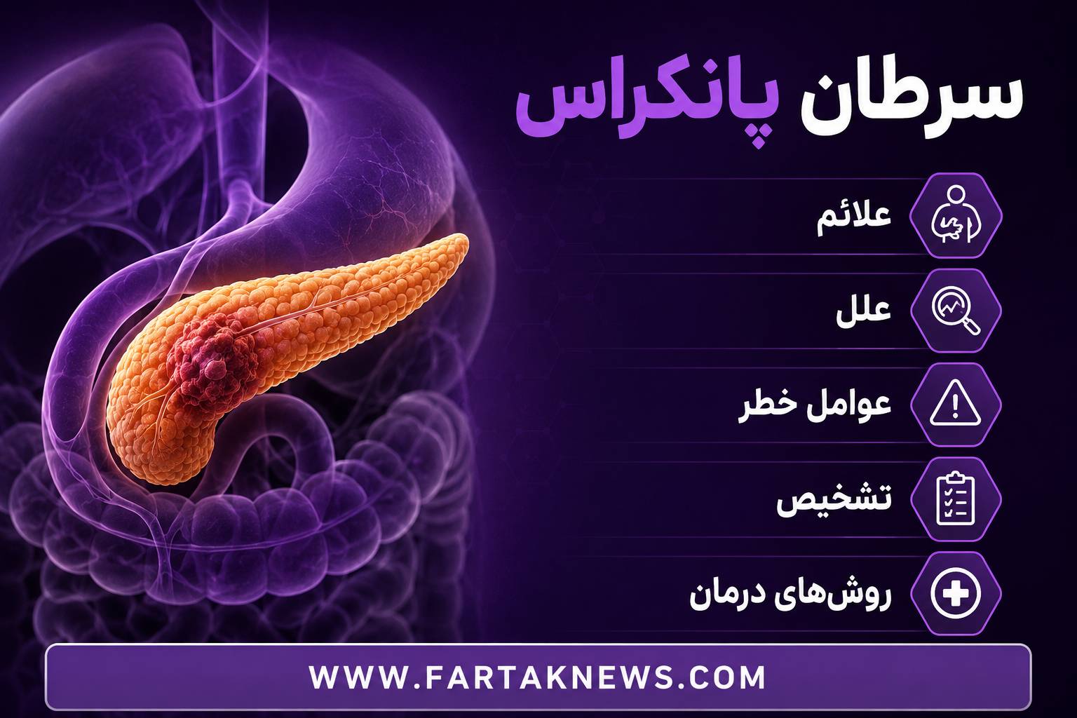 سرطان پانکراس