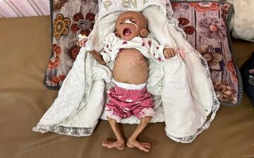 ادامه فاجعه انسانی در نوار غزه؛ نوزاد ۶ ماهه فلسطینی از گرسنگی جان باخت