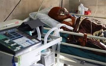 فوت 26 نفر بر اثر سوختگی در پنج ماهه سال جاری در کرمانشاه



