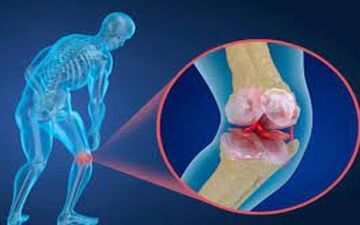 علائم هشداردهنده پوکی استخوان