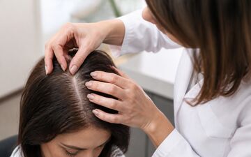 ریزش موی ارثی؛ راهکارهای نوین تشخیص و مدیریت در ایران
