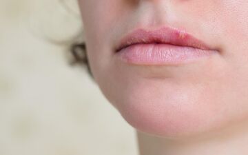 شایع‌ترین و خطرناک‌ترین بیماری های لب