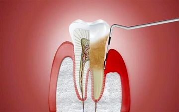 دستاورد تازه دانش‌بنیان‌های ایرانی؛ تولید نانوساختاری برای بازسازی استخوان
