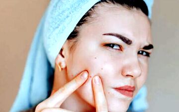 کدام ویتامین ها برای درمان آکنه مفیدند