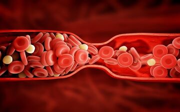 گرفتگی رگ های قلب را با این تفریح باز کنید