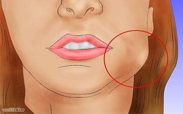 کاهش ورم و تورم صورت بعد از عمل جراحی 