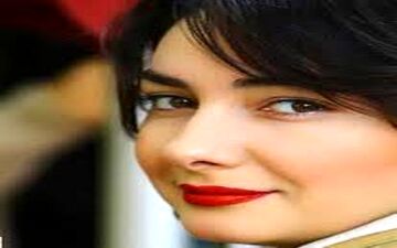 تغییرات ظاهری مشهود خانم بازیگر مشهور