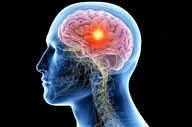 زنگ خطرهای پنهان؛ وقتی تومور مغزی خودش را پشت علائم ساده قایم می‌کند!