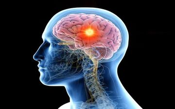 زنگ خطرهای پنهان؛ وقتی تومور مغزی خودش را پشت علائم ساده قایم می‌کند!