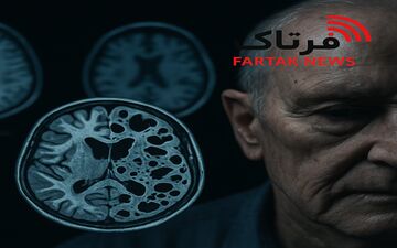 بیماری کروتزفلد-یاکوب چیست و چرا این‌قدر خطرناک است؟