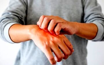 علائم هشدار دهنده این بیماری روی پوست