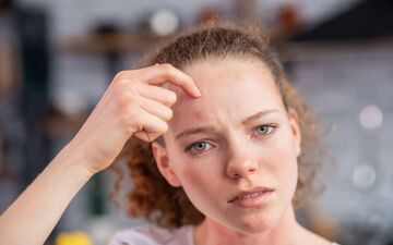 علت خارش پیشانی چیست و چه زمانی باید به پزشک مراجعه کنیم؟