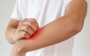 اگزما چیست؟ همه چیز درباره این بیماری پوستی شایع (فیلم)