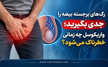 رگ‌های برجسته بیضه را جدی بگیرید؛ واریکوسل چه زمانی خطرناک می‌شود؟