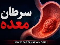 علائم سرطان معده؛ چه زمانی سوءهاضمه می‌تواند زنگ خطر باشد؟