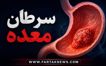 علائم سرطان معده؛ چه زمانی سوءهاضمه می‌تواند زنگ خطر باشد؟