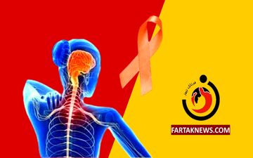 ابتلای ۱۲۰ هزار نفر به بیماری ام اس در کشور