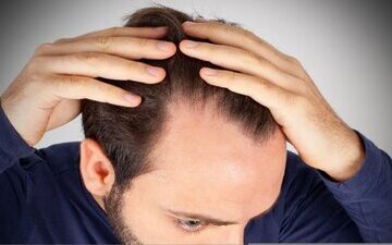 غذاهایی که ممکن است ریزش مو را تشدید کند

