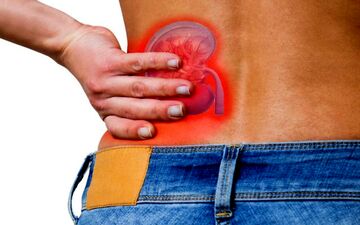 آیا سنگ کلیه باعث یبوست می شود ؟

