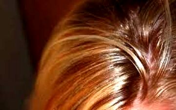دلایل چرب شدن موی سر و راههای کاهش آن