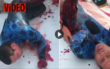 لحظه دلهره آور نجات غواص زخمی پس از حمله مرگبار کوسه