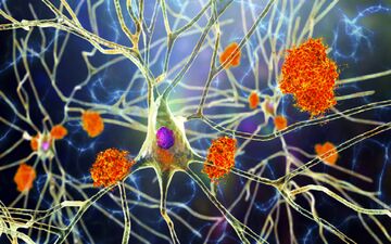 مصرف تخم مرغ باعث عدم ابتلا به آلزایمر می‌شود؟
