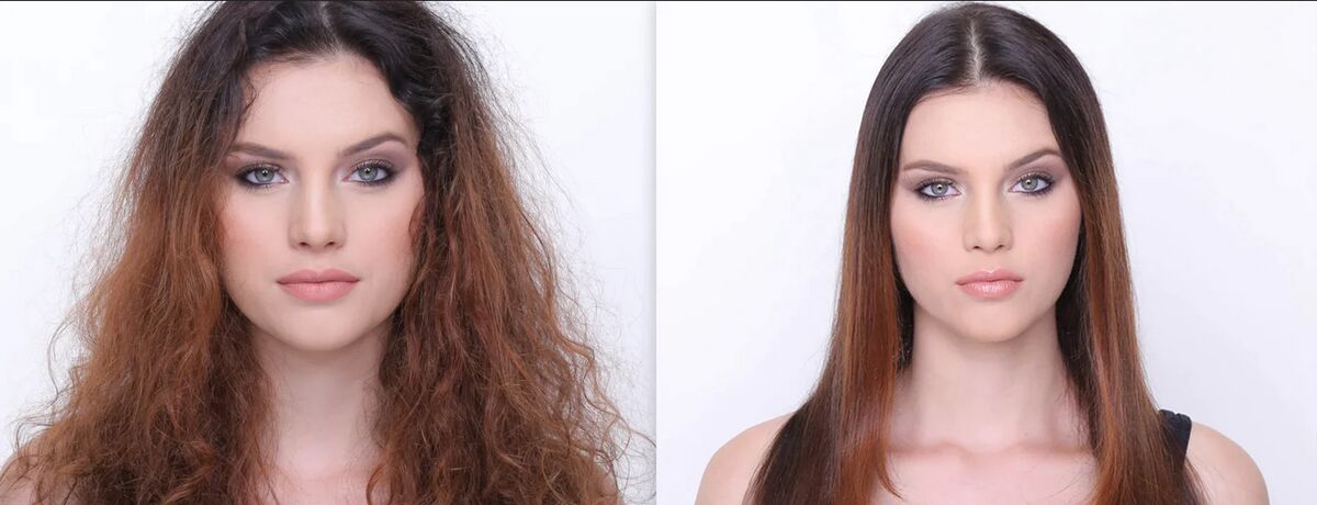 وزی مو را چطوری از بین ببریم؟