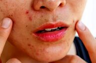 راهنمای سلامت پوست در بهار؛ از مدیریت استرس تا پاکسازی‌های تخصصی

