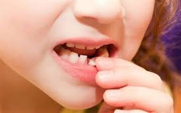 به این دلایل مراقب دندان‌های شیری فرزندانتان باشید!