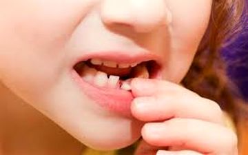 به این دلایل مراقب دندان‌های شیری فرزندانتان باشید!