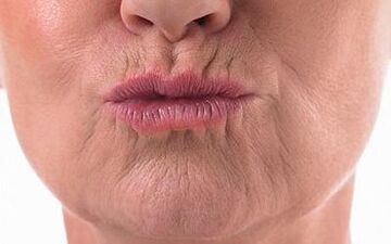 چگونه چین و چروک دور لب را از بین ببریم؟ رازهای زیبایی برای داشتن چهره‌ای جوان‌تر