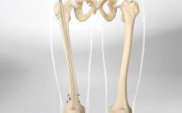 از چه سنی استخوان‌ شروع به تحلیل رفتن می کند؟