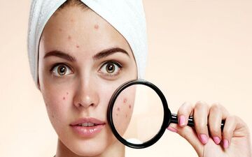 4 نوشیدنی که آکنه شما را از بین می برد