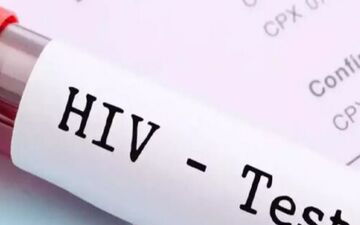 آیا HIV به صورت طبیعی درمان خواهد شد؟

