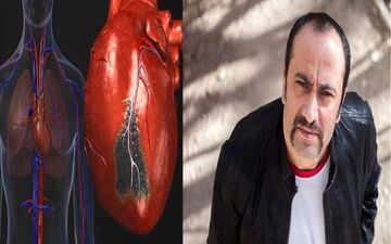  چگونه سکسکه باعث مرگ «عارف لرستانی» شد؟