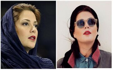 چهره تغییر کرده طناز طباطبایی بعد از عمل زیبایی ! / قطعاً با دیدن عکس او شوکه می شوید !