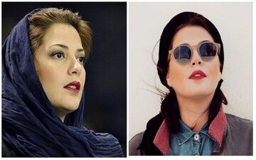 چهره تغییر کرده طناز طباطبایی بعد از عمل زیبایی ! / قطعاً با دیدن عکس او شوکه می شوید !