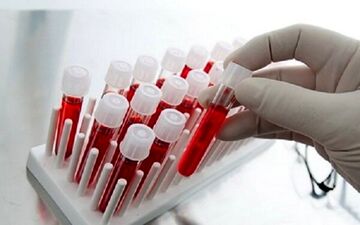 بازگشت پالایشگاه خون به دولت پس از ۱۰ سال