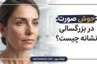 جوش صورت در بزرگسالی نشانه چیست؟ راهنمای بررسی و اقدام‌های اولیه