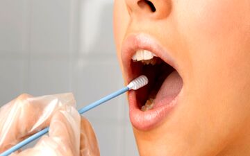  غدد بزاقی چه نقشی در بدن دارند