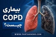 بیماری COPD چیست؟ علائم و عوامل خطر بیماری انسدادی مزمن ریه