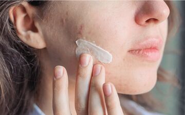 از بین بردن لک صورت با خمیر دندان؛ واقعیت یا یک باور غلط؟