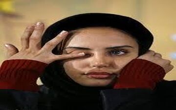 الناز شاکردوست با پاهایی شکسته!