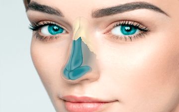 جراحی ترمیمی بینی کوتاه چگونه است؟
