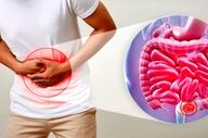 سه عارضه مهم ابتلا به یبوست