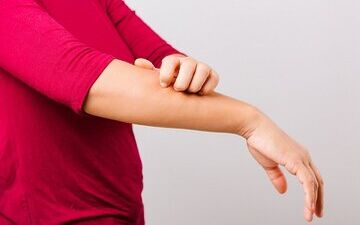خارش شدید شبانه بدن به چه علت است؟