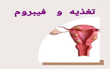 ارتباط بین ویتامین D و فیبروم چیست؟
