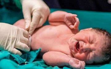 کدام زایمان عوارضش کمتر است؟