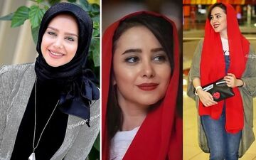 الناز حبیبی قبل از عمل زیبایی بینی
