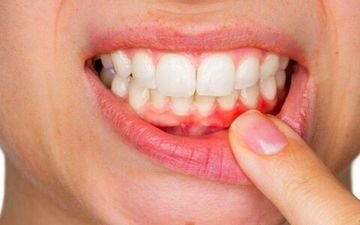 احتمال ابتلا به زوال عقل درصورت داشتن لثه‌های ناسالم 